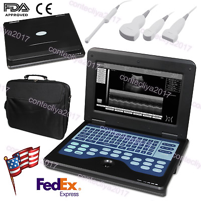 FDA CE 10.1 Inch Portable Ultrasound Scanner Laptop Machine CMS600P2 For Human #ad $1749.00
