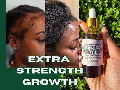 Organic Black Rice Oil for FAST Growth Dry Scalp Rice Peppermint Black Seed $12.00