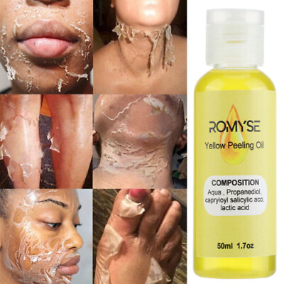 #ad Extra Strong Yellow Peeling Oil Dark Skin Face Body Brightening Exfoliating 50ML $9.28