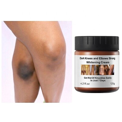 #ad Dark Skin Bleach Body Bleaching Cream Max Strength Whitening Lightening AHA $20.95