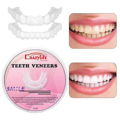 #ad #ad Instant Smile Perfect Teeth Temporary Snap Replacement Fake Veneers Tooth Kit $8.58