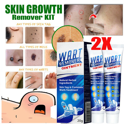 #ad 2X Skin Wart Tag Remover Cream Antibacterial Extract Corn Plaster Warts Ointment $9.68