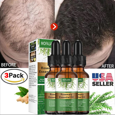 3Pcs Rosemary Essential Oil for Hair Growth 100% Pure Natural Therapeutic Grade $15.65
